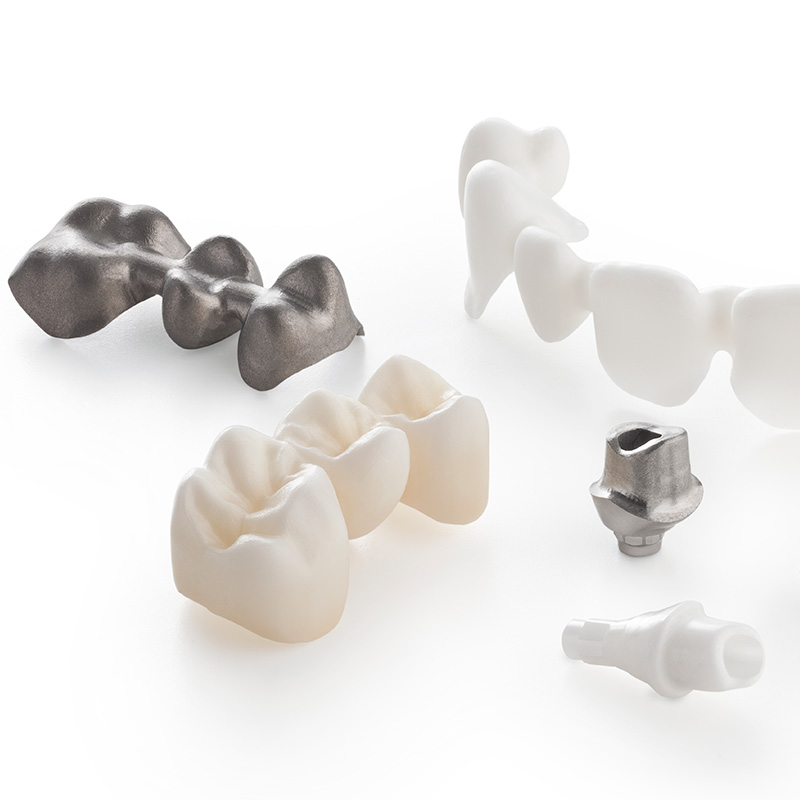 Vollkeramische Lösungen sorgen für natürliches Aussehen der neuen Zähne.
