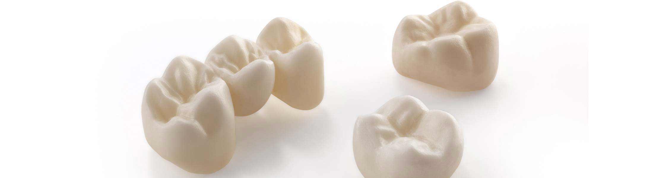 Implantatprothetik aus Keramik