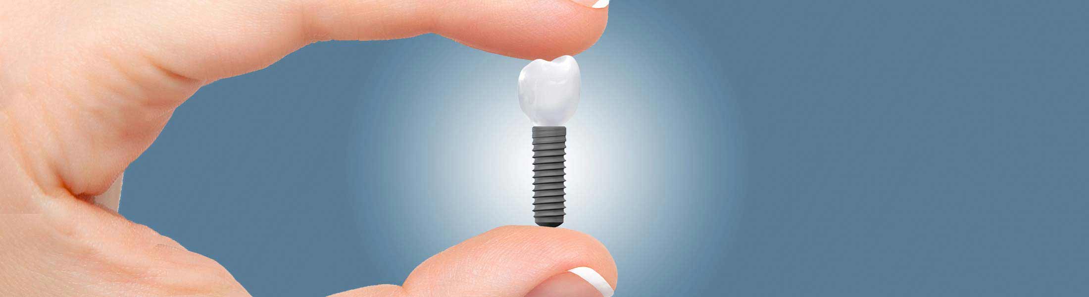 guenstige Implantate