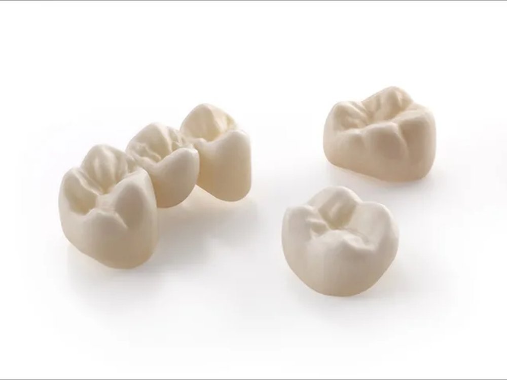 Crowns and pontics in all-ceramic zirconia